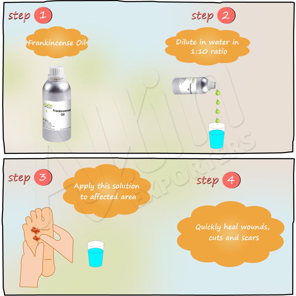 Allin Exporters Frankincense Oil 100% Pure, Natural, Undiluted & Therapeutic Grade Great For Aromatherapy For Aging Skin